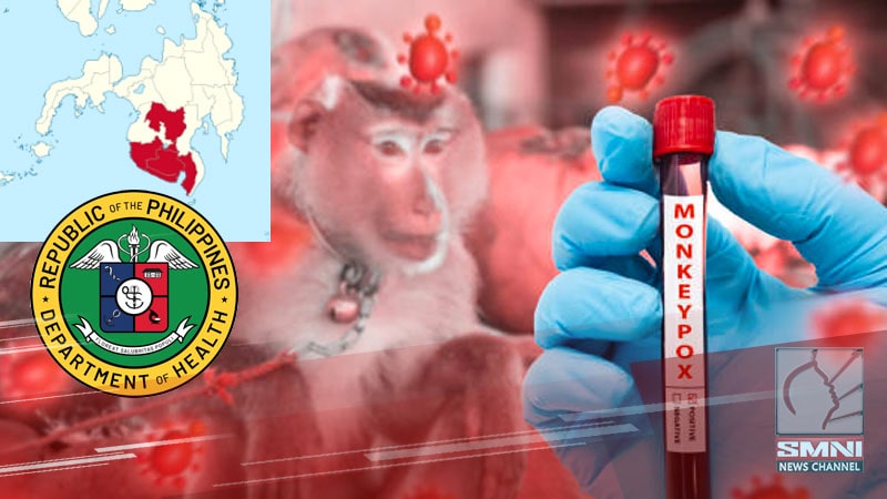 Isang kaso ng Mpox kumpirmado sa SOCCSKSARGEN