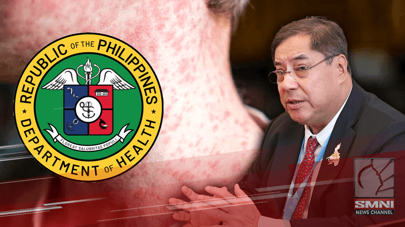 Kaso ng tigdas sa bansa tumaas