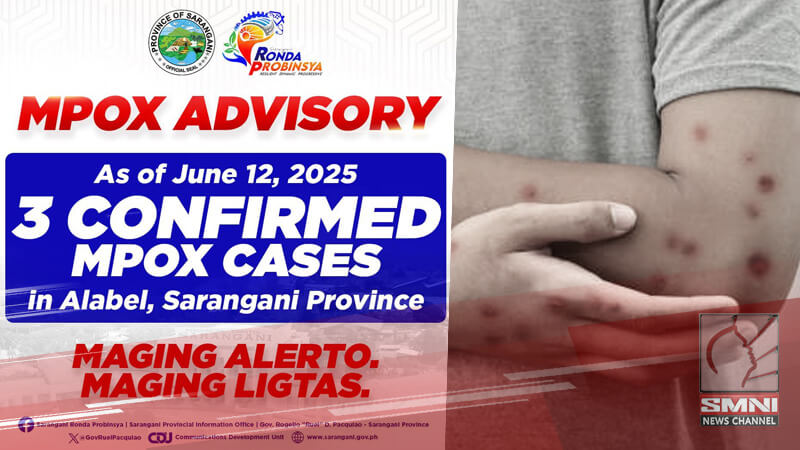 3 kaso ng Mpox kumpirmado sa Alabel, Sarangani