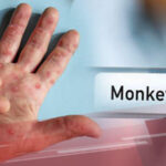 Mpox
