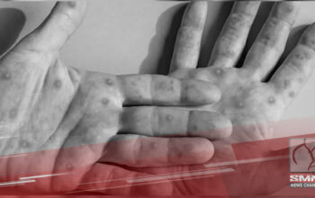 Mpox